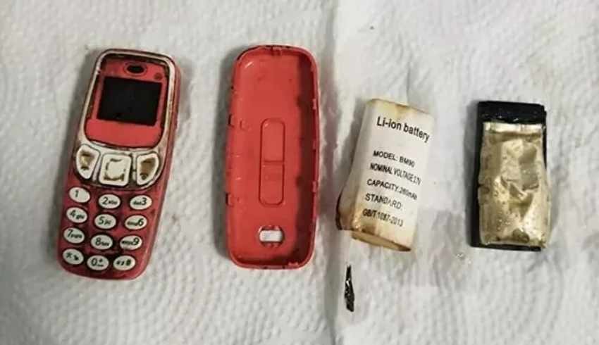 33 yaşındaki erkeğin midesinden Nokia 3310 çıktı!